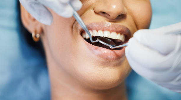 Best Emergency Root Canal Treatment in Midlothian, TX