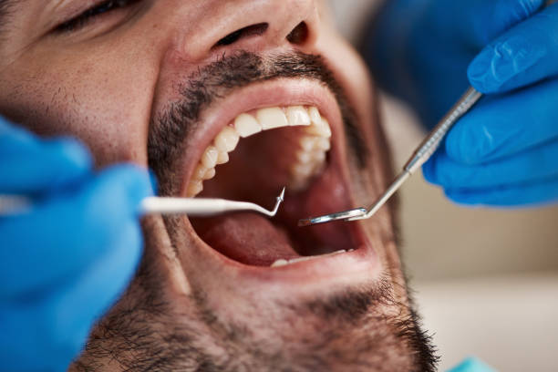 Best Emergency Treatment for Dental Infections or Abscesses in Midlothian, TX
